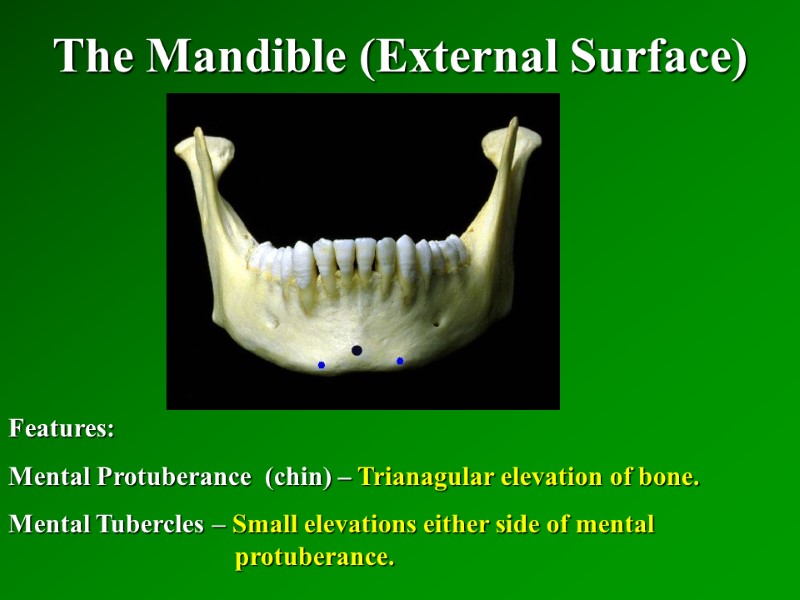 The Mandible (External Surface)   Features: Mental Protuberance  (chin) – Trianagular elevation